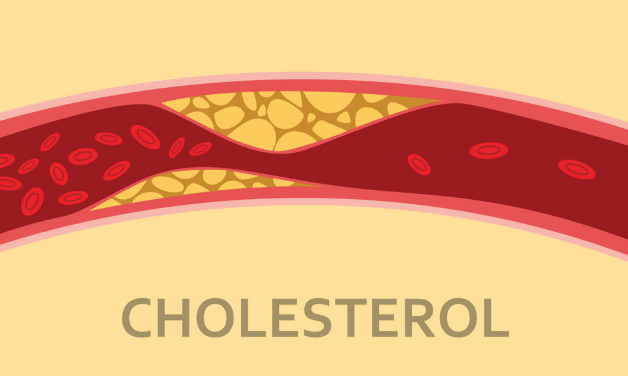 cholesterol cho bé