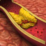 Cholesterol có vai trò gì, nguy hiểm ra sao